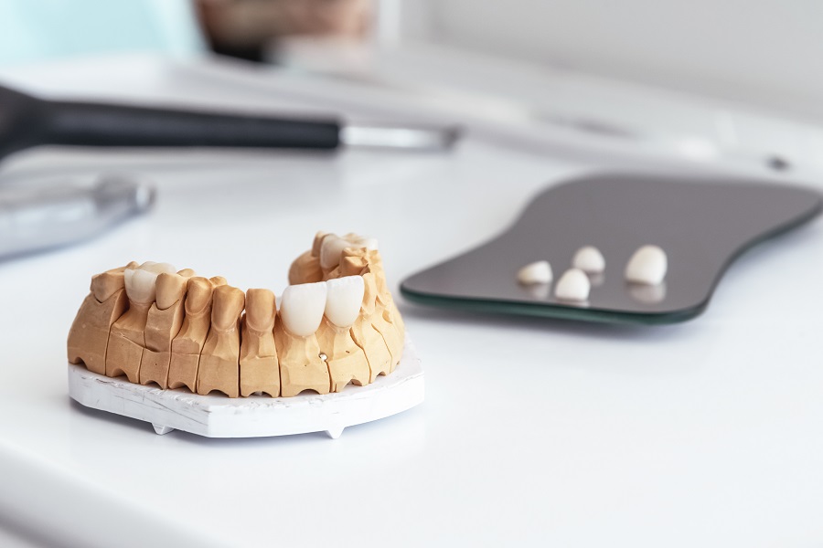 Make Cosmetic Dental Issues Vanish with Veneers